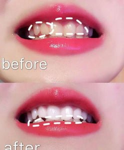 20 minutes fast teeth whitening